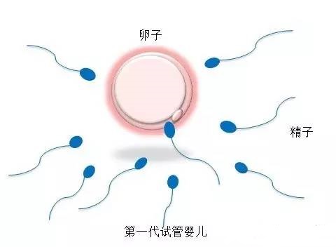 关于供卵试管代生